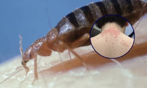 عائلة تقاضي الخطوط الجوية الملكية الهولندية (KLM) بسبب لدغ وزحف بق الفراش على متن الطائرة